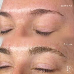 Microblading